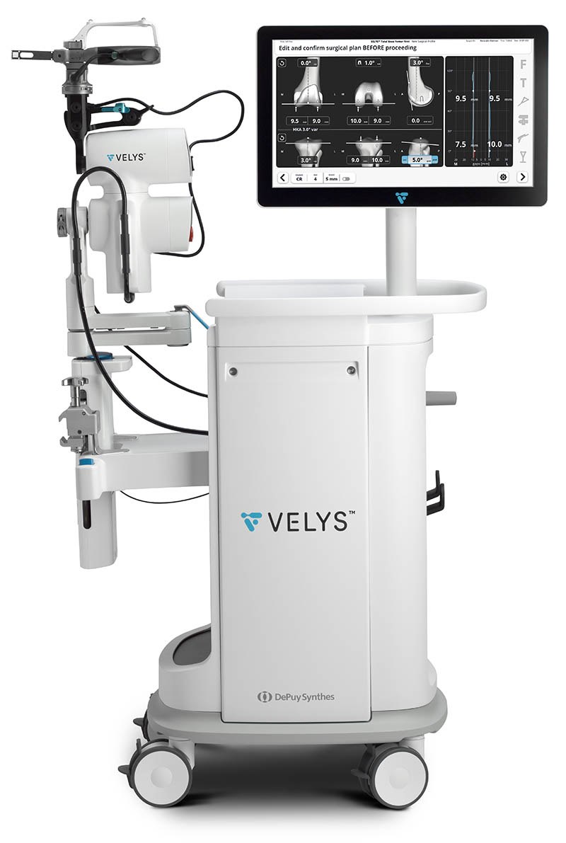The VELYS robotic-assisted surgery system, showing its on-screen surgical plan